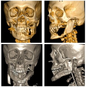 pre e post operatorie (1)