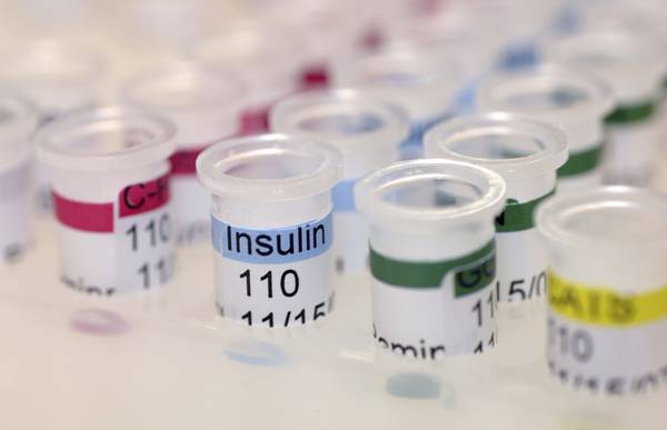 11-09-07 - Detail Photos of Lab instruments and things used in the Davis Lab in the new MRB IV. (Vanderbilt Medical Center/Neil Brake)
Detail
Science & Research11-09-07 - Detail Photos of Lab instruments and things used in the Davis Lab in the new MRB IV. Detail photo of test tubes for insulin.  (Vanderbilt Medical Center/Neil Brake)
Detail
Science & Research