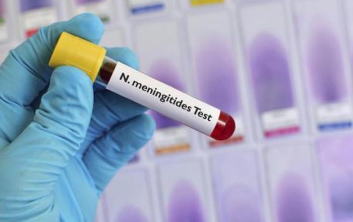 Meningite, un bimbo muore a Firenze. Grave donna in Liguria