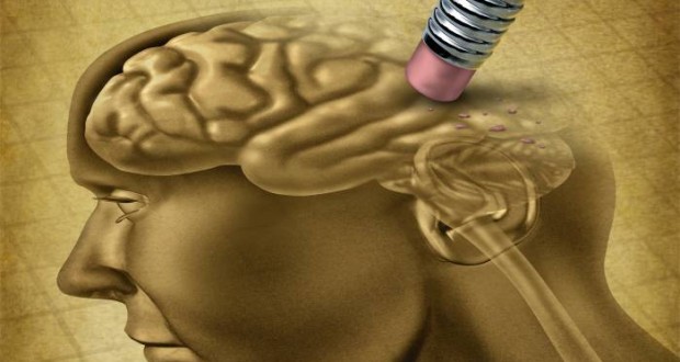 alzheimer-620x330