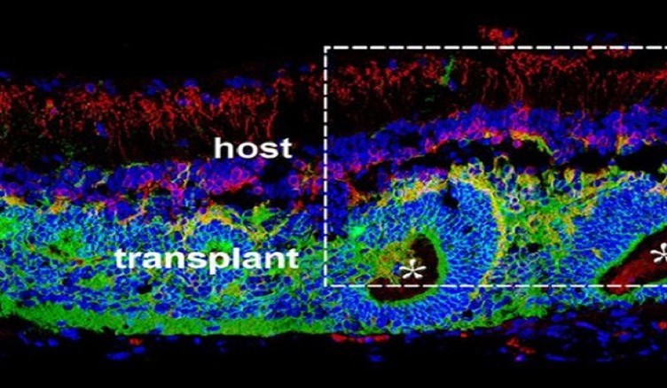 trapiajnoto-retina