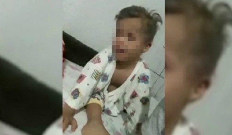 bimbo_morto_attesa_ospedale_sindrome_down