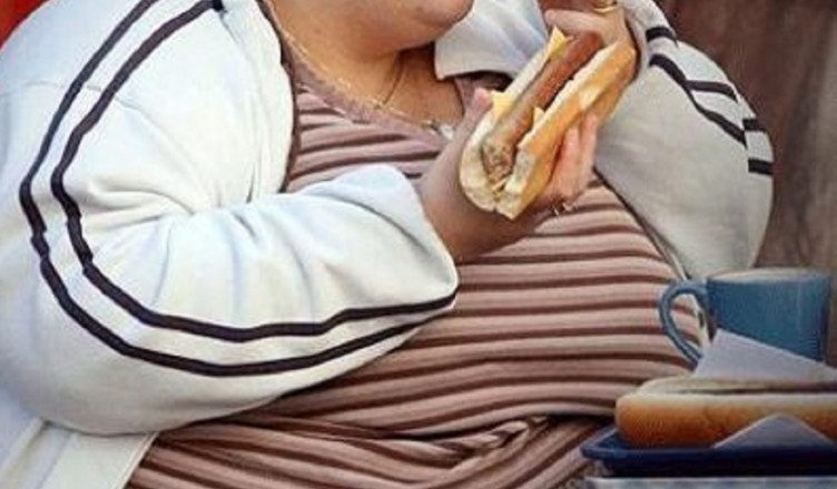 obesità donne