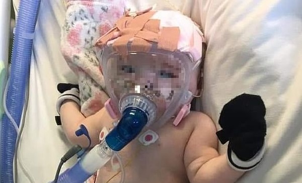 bambino operata al cuore