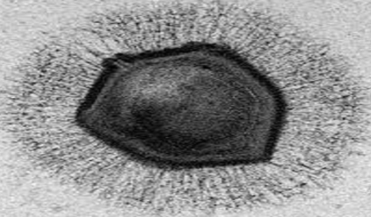 virus gigante