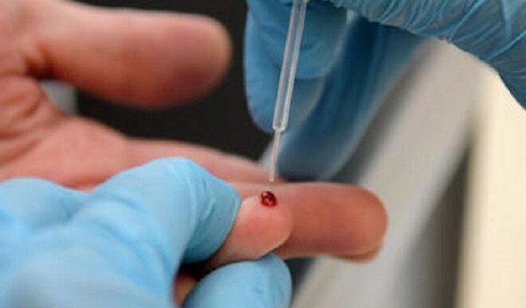 test sierologici coronavirus