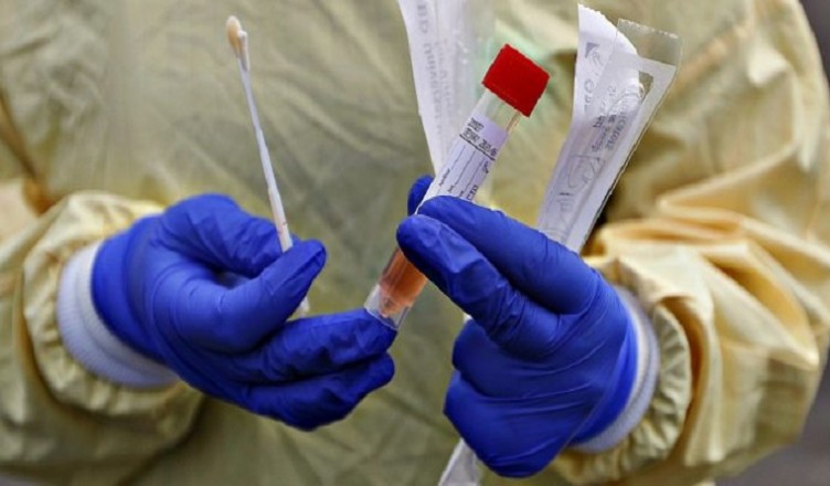 tampone coronavirus