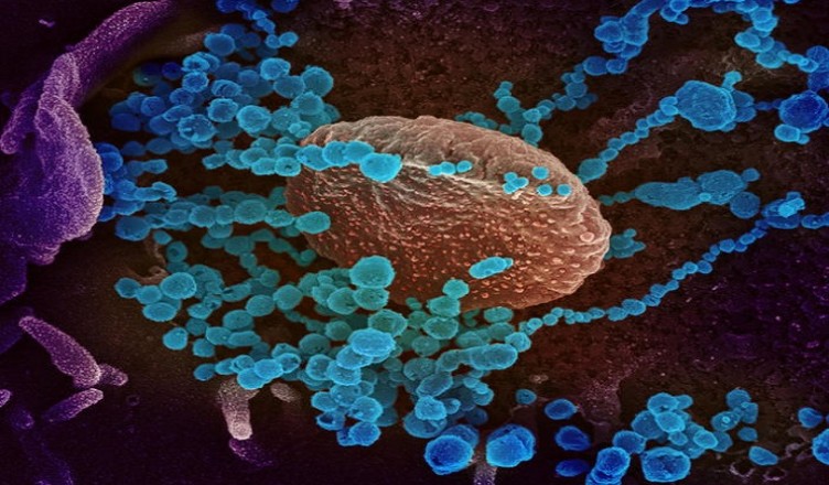 Research on novel coronavirus 2019, National Institutes of Health