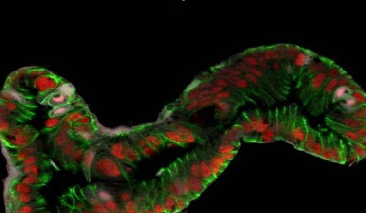 intestino corto