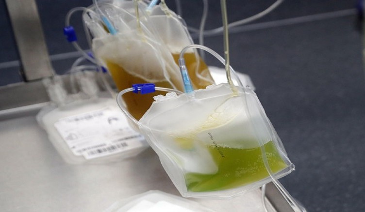 plasma...