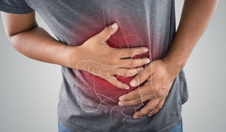 colon-irritabile-diverticolite...