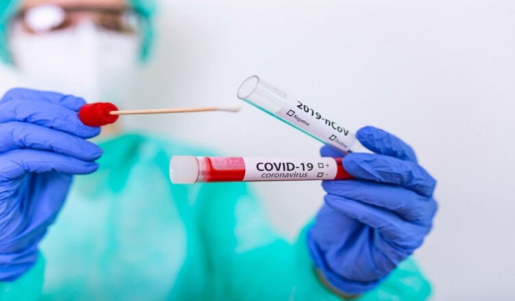 TAMPONE-CORONAVIRUS-COVID-scaled
