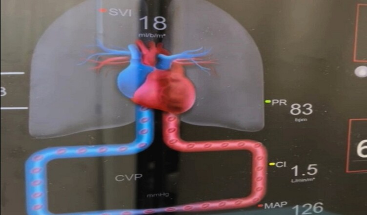 Foto cardiologia