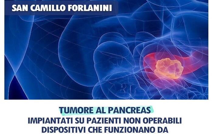 tumore pancreas forlanini roma