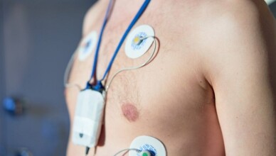 ELETTROCARDIOGRAMMA E HOLTER IN FARMACIA
