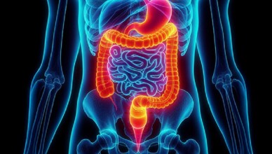 tumore colon